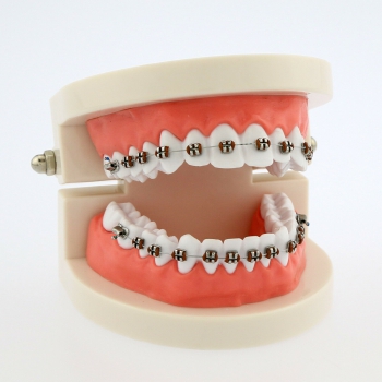 Dental Teach Typodont Demonstration Teeth Model with Braces For Patient Study 50...