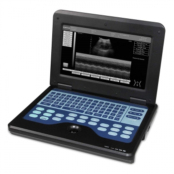 CONTEC CMS600P2 Vet Veterinary use Portable Laptop B-Ultra Sound Scanner Machine for Horse/Equine/Cow/Sheep use