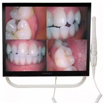 Magenta YFHD-D Dental Intraoral Camera 1/4 sony CCD with 17 Inch Monitor & Brack...