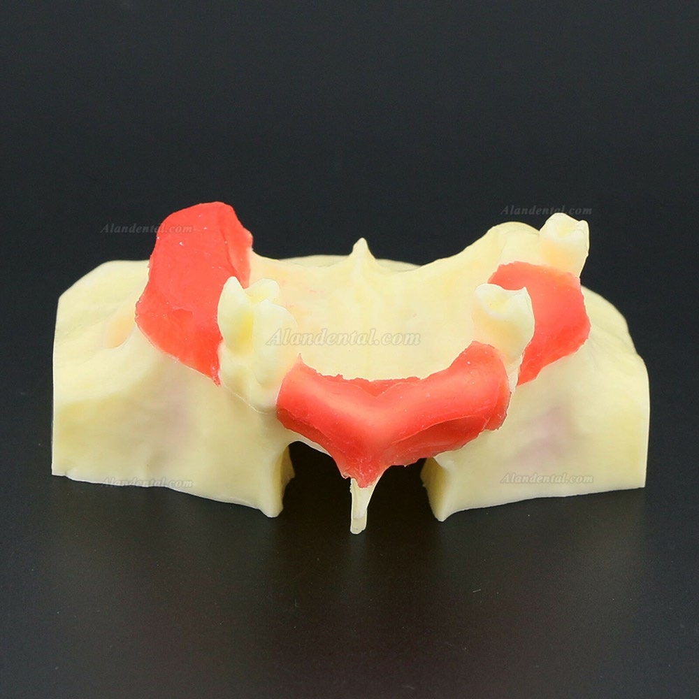 1Pcs Dental Teeth Model Study Teach Model Sinus Lift Practice Model  2013 01