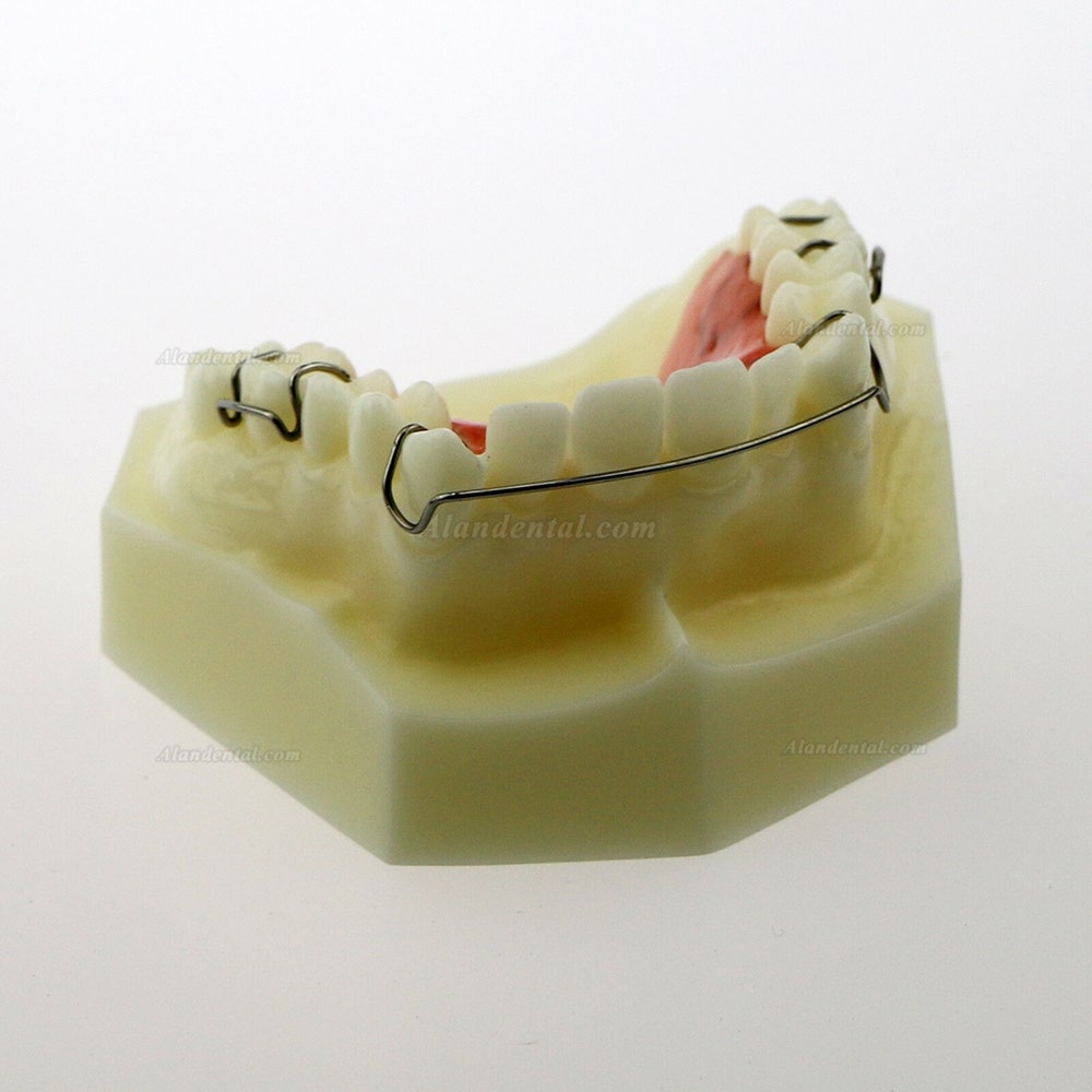 Dental Model #3007 01 - Hawley Retainer Model