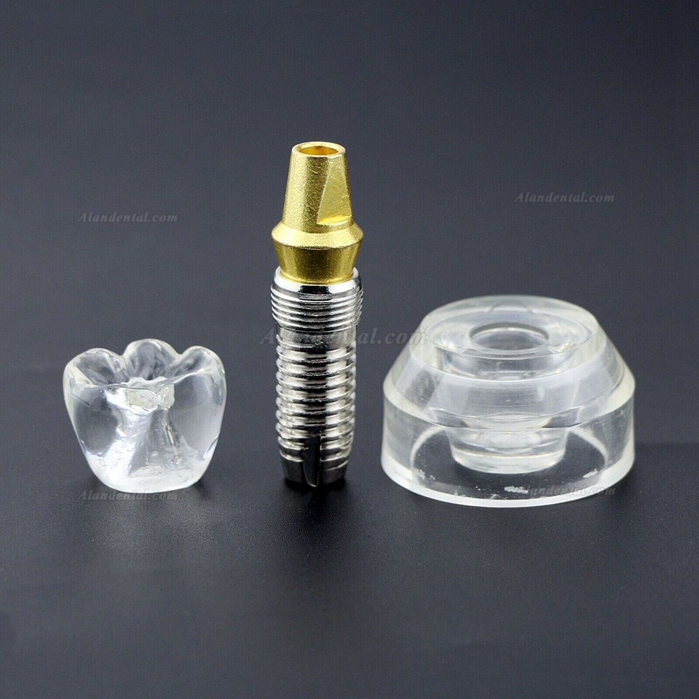Dental Implant Demonstration Model 2.5x Size Detachable Transparent