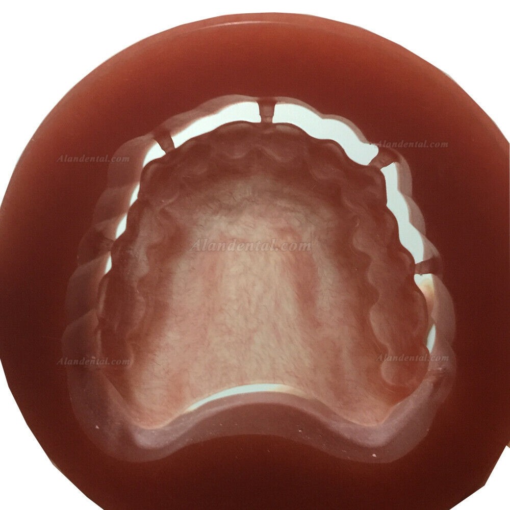 5 Pcs 98mm Dental Lab Pink PMMA Blocks Disk with Bloodshot (Wieland System)