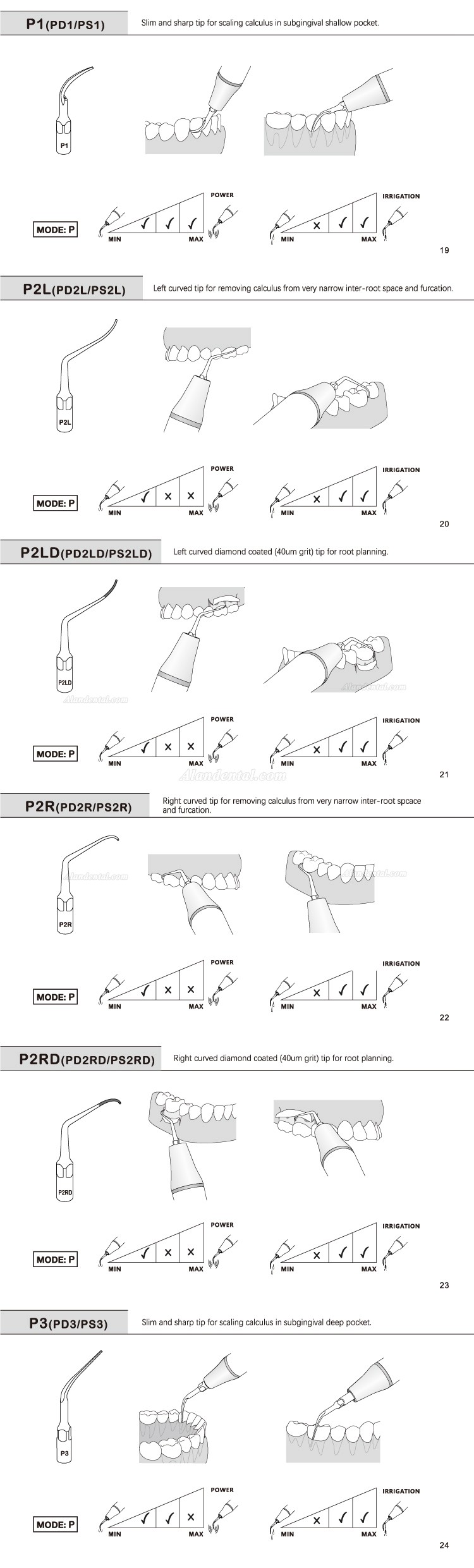 5Pcs Refine® Dental Ultrasonic Tips P2L P2R P2LD P2RD P5 P6 P7 P8 P10 P11 P12 P14L Fit For EMS Woodpecker Scaler Handpiece
