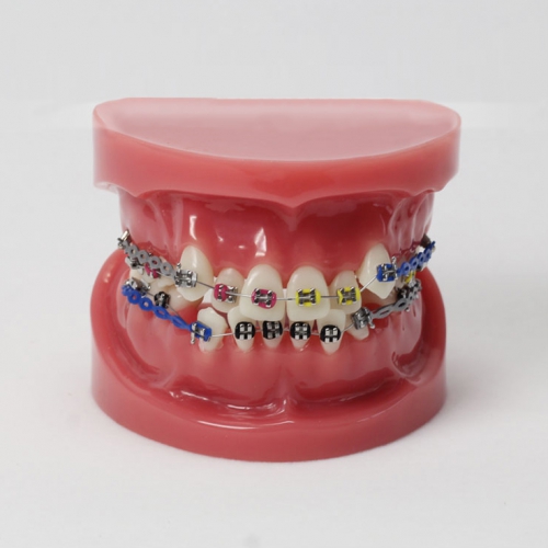 Dental Teeth Malocclusion Correct With Teeth Bracket Standard Model M3005