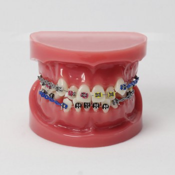 Dental Teeth Malocclusion Correct With Teeth Bracket Standard Model M3005