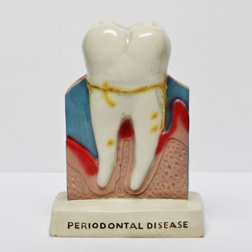 Dentist Dental Teeth Oral Anatomy Teaching Standing Decoration Model Figure