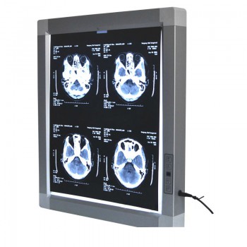 JINDETECH X Ray Film Viewer Medical Diagnostic E.N.T LED Illuminator View Box