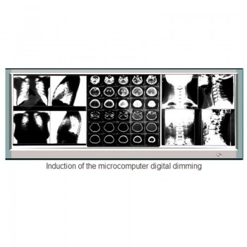Ultra-thin X Ray Film Viewer Medical Diagnostic LED Illuminator View Box 1100H