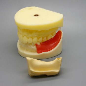 Dental Implant Surgery Practice Model With Replaceable Gingiva 2002