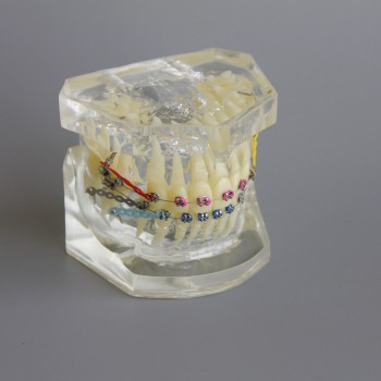 Dental Orthodontic Demonstration Practice Model With Metal Bracket Archwire
