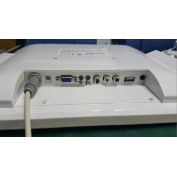 15 Inch Wired Dental Monitor Intra Oral Camera System VGA+VIDEO port With LCD holder MD1500