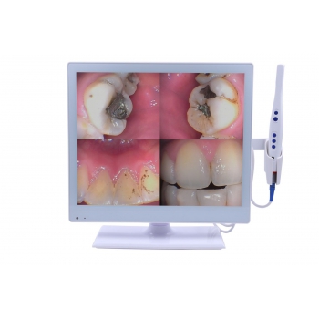 Dental 2-in-1 Wired Intraoral Camera with 17 Inch LED Monitor M-978 HDMI USB VGA