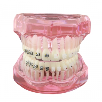 Dental Orthodontic Teeth Model Metal and Ceramic Bracket Braces Study Model 3003