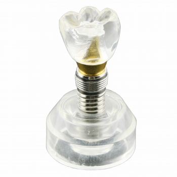 Dental Teeth Model Implant Model Demonstration Study Teach Model Demo 2020