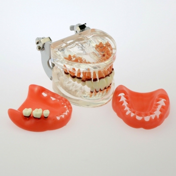 Dental Model Adult Pathological Periodontal Disease Study Teeth Model 4017