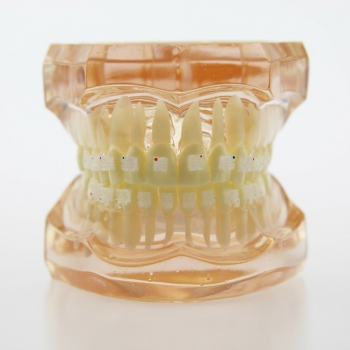 Dental Orthodontic Treatment Model Brackets Ceramic Metal Typodont Demo Studying...