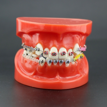 Dental Orthodontics Treatment Study Model With Metal Bracket Arch Wire Chain Tie...