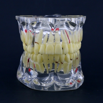 New Dental Teach Study General Adult Pathology Typodont Teeth Model #4001