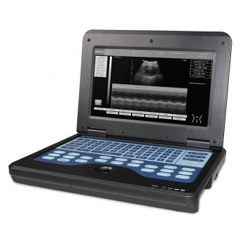 CONTEC CMS600P2 Vet Veterinary use Portable Laptop B-Ultra Sound Scanner Machine for Horse/Equine/Cow/Sheep use