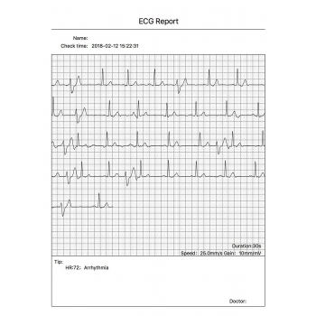 CONTEC Portable ECG/EKG Monitor PC Software Electrocardiogram Bluetooth Heart Rate Beat LCD Monitor PM10