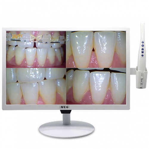 MLG M-978A Dental Intra Oral Camera 5G Wireless WIFI with 19 inch LCD Monitor