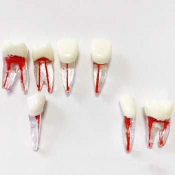 Dental Teeth Model Endo Files Practise Molar Upper Lower Tooth Premolar Root 2/3-Rooted Canal