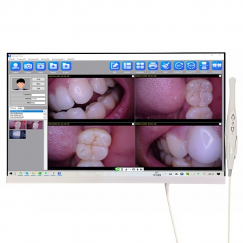 Magenta YF-2400P 24 Inch Touch Screen Dental Intraoral Camera with WIFI