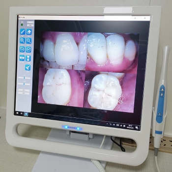 Magenta YF-1700P+ Dental 17 Inch Touch Screen Intraoral Camera