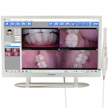 Magenta YF-2200P+ Dental 21.5 Inch Touch Screen Intraoral Camera VGA+HDMI