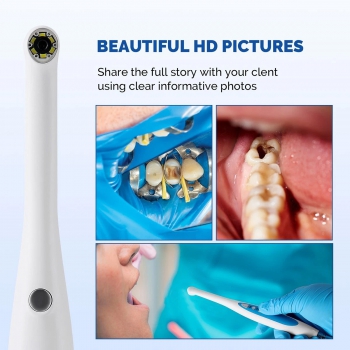 Magenta MD280 720P HD USB Dental Intraoral Camera for Win 10/11