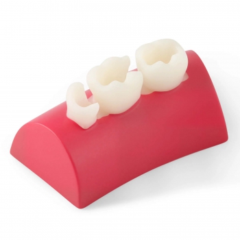 Dental Inlay Exercise Block Composite Resin Filling Teeth