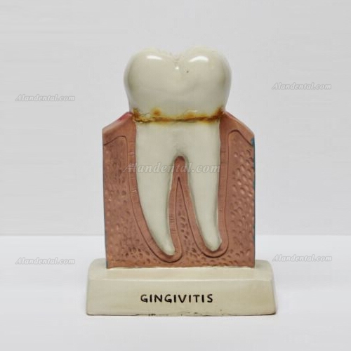 Dentist Dental Teeth Oral Anatomy Teaching Standing Decoration Model Figure