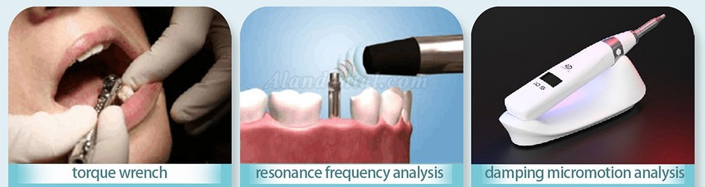 YAHOPE iCHECK Implant Stability Meter Dental Implant Osseointegration Monitor