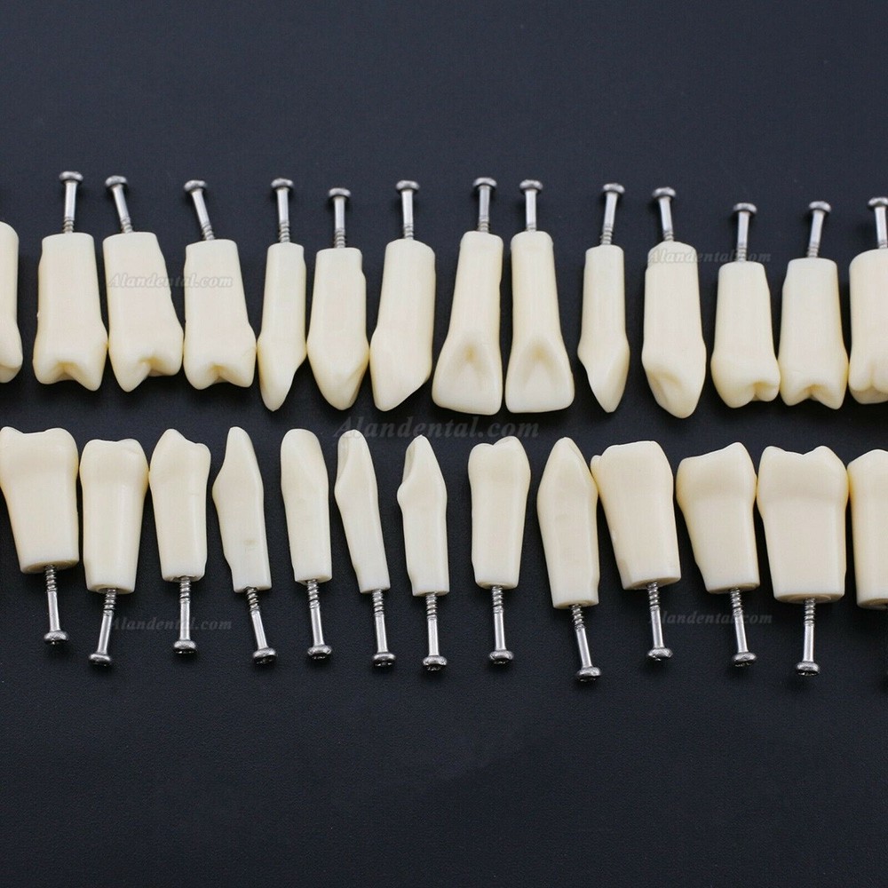 US 28Pcs Screw-in Dental Typodont Teeth Model Teeth fits Kilgore NISSIN