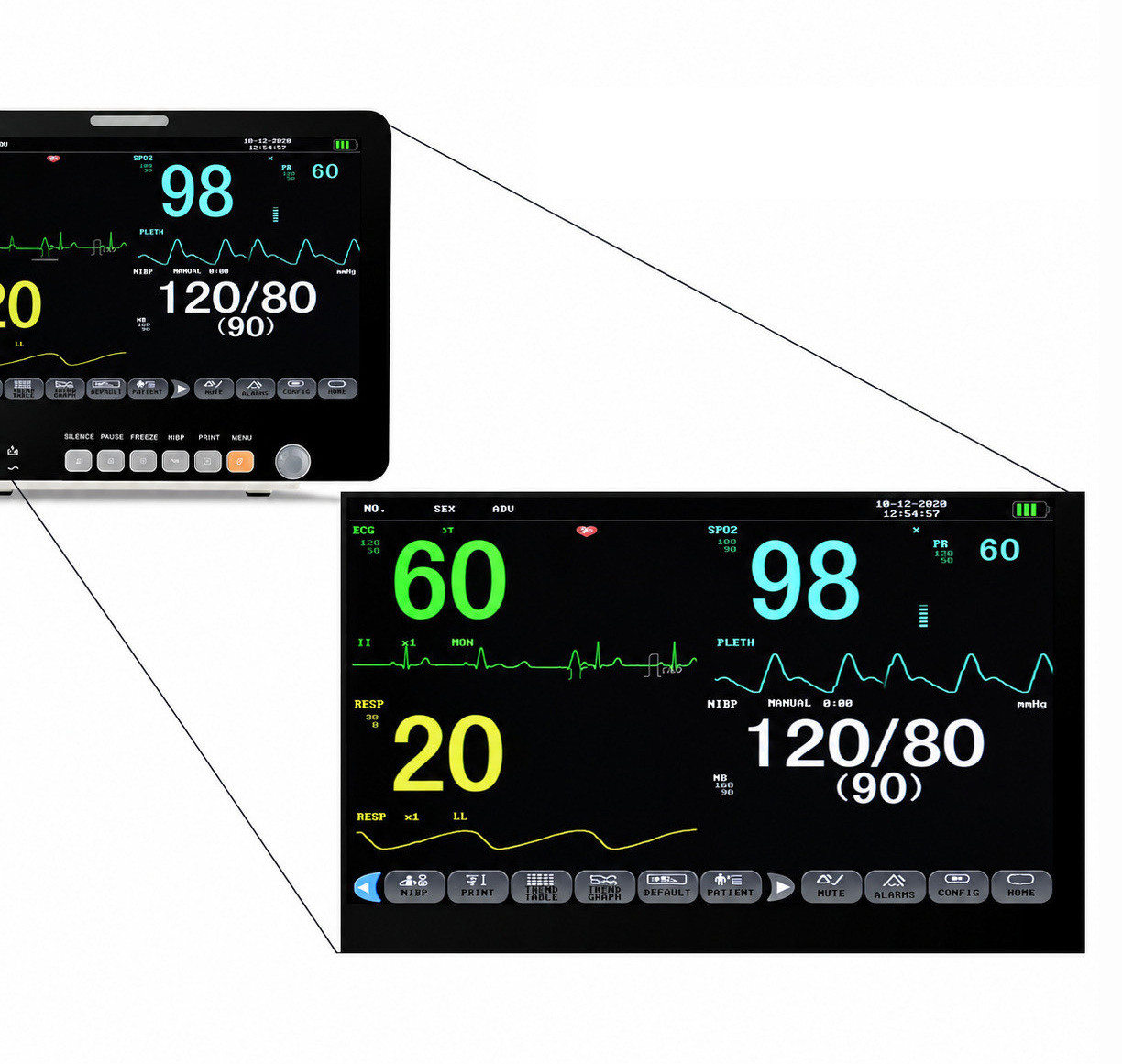 15.6" Multi-parameter Patient Monitor ECG NIBP RESP TEMP SPO2 PR 