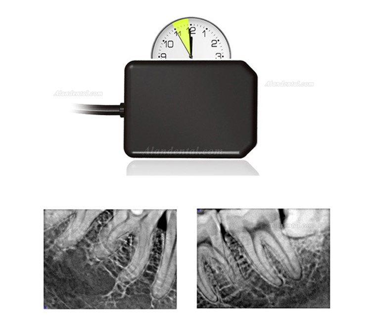 High Resolution Digital USB Type Dental X Ray Sensor Rvg
