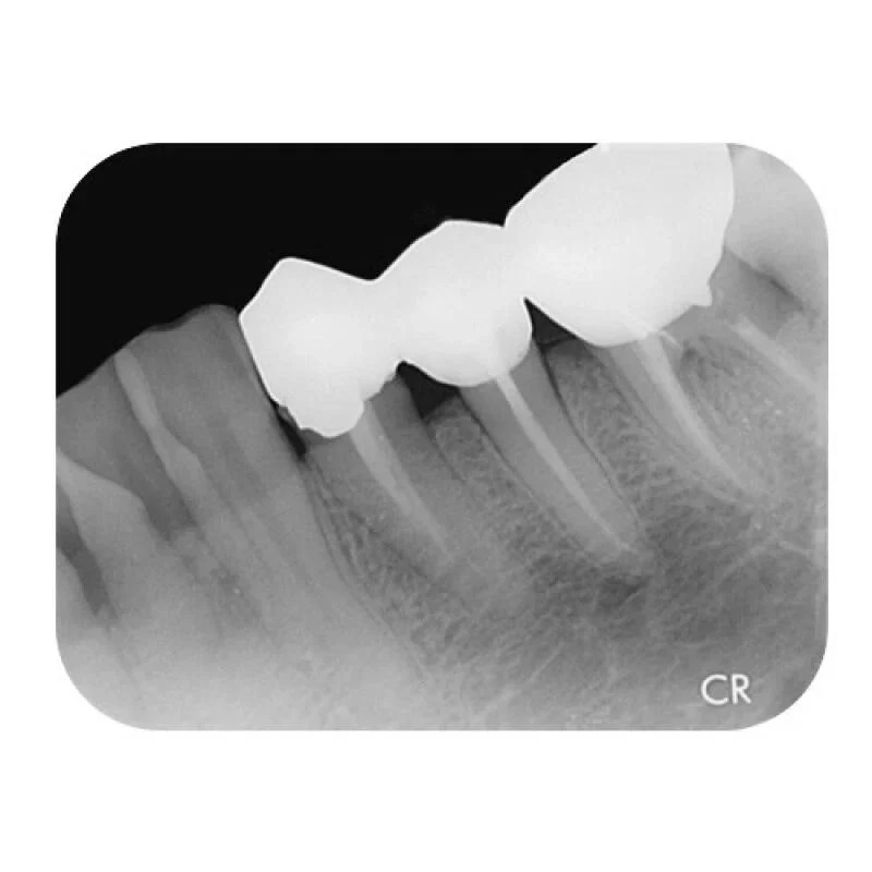 Apixia Dental Digital Phosphor Plate Scanner (PSP Scanner)