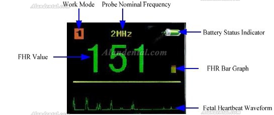 Baby Sound Monitor Sonoline C Pocket Fetal Doppler