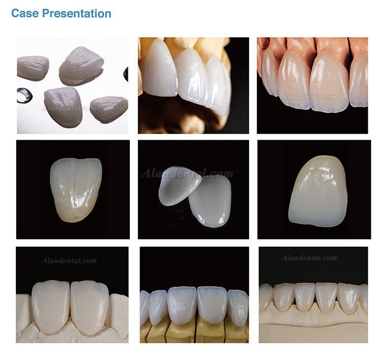 5Pcs/Box Aidite® C14 Cad/Cam Lithium Disilicate Glass Ceramic Block for Dental Lab Veneer and Anterior Teeth Material