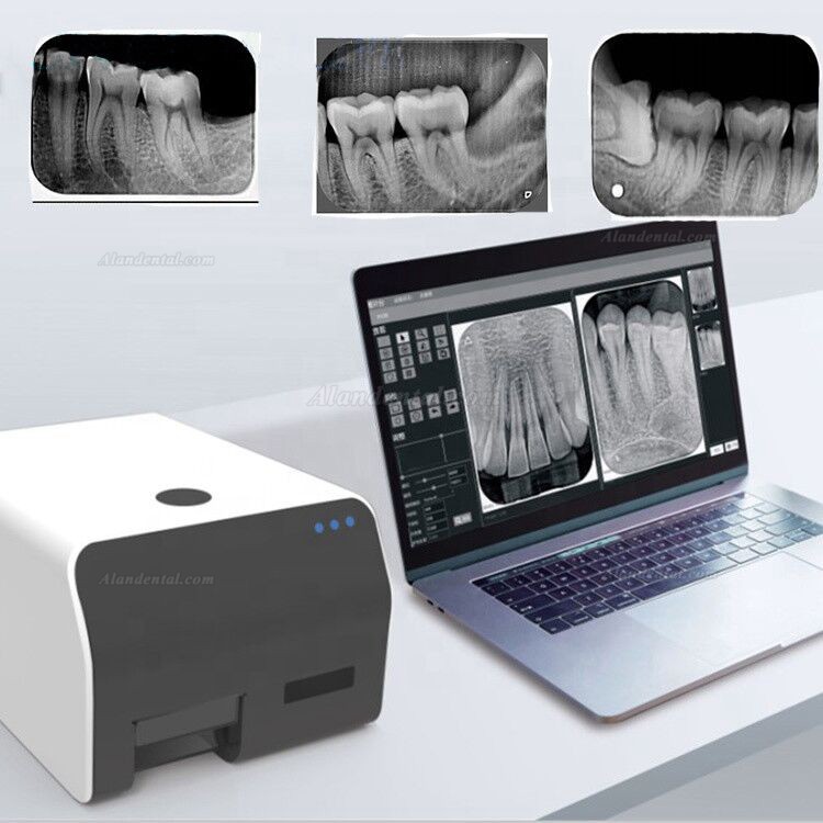 Vrn EQ 600 PSP Scanner Dental Phosphor Plate Scanner