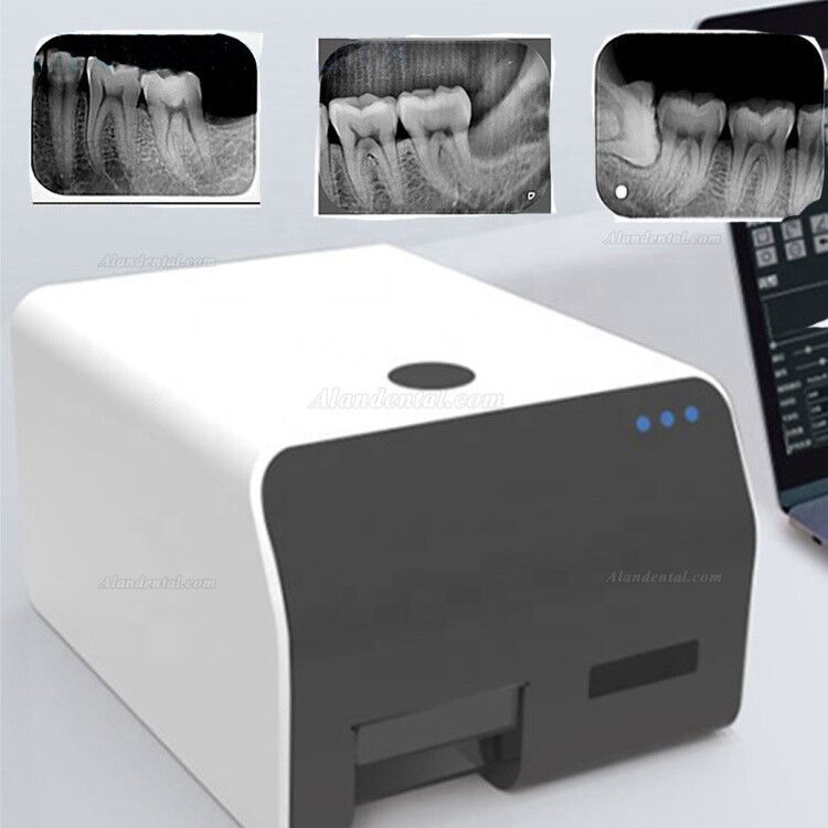 Vrn EQ 600 PSP Scanner Dental Phosphor Plate Scanner