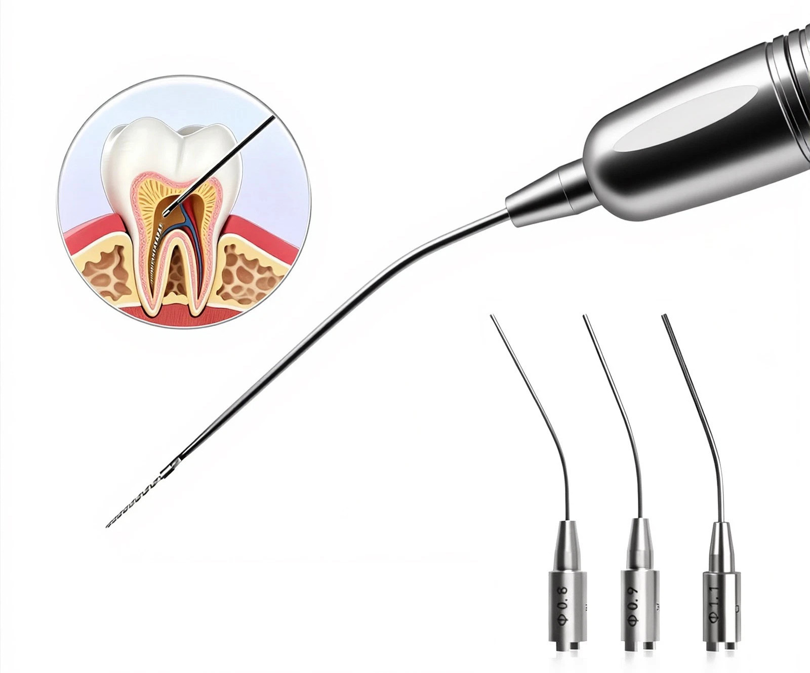 Dental Endo File Removal System Root Canal Broken File Extractor