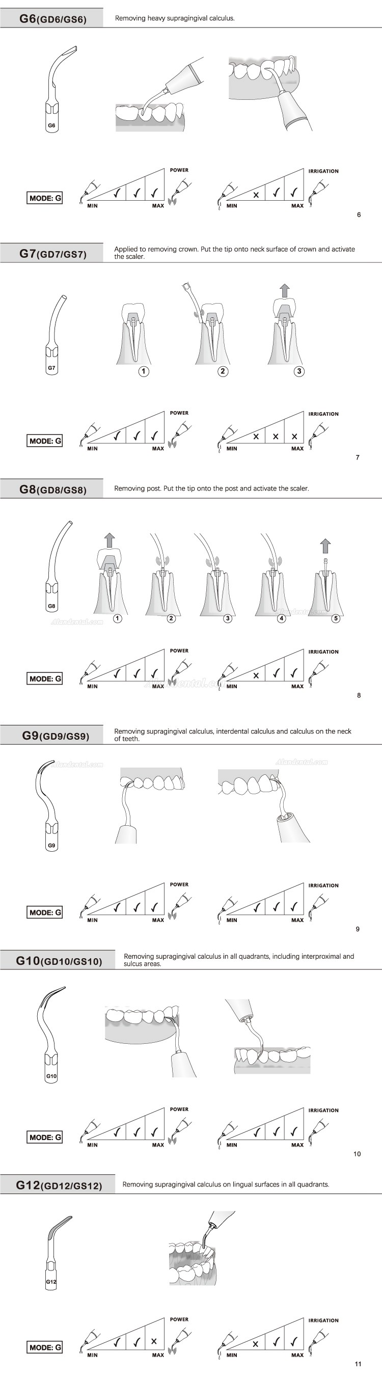 10Pcs Refine® Dental Scaler Tips G1 G2 G3 G4 G5 G6 GD1 GD2 GD3 GD4 GD5 GD6 Compatible with EMS Woodpecker