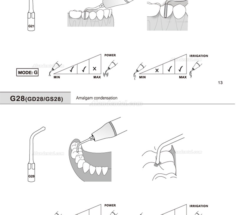 5Pcs Refine® Ultrasonic Scaling Tips G20 G21 G30 G31 G32 G33 G35 Compatible with REFINE EMS Woodpecker Scaler Handpiece