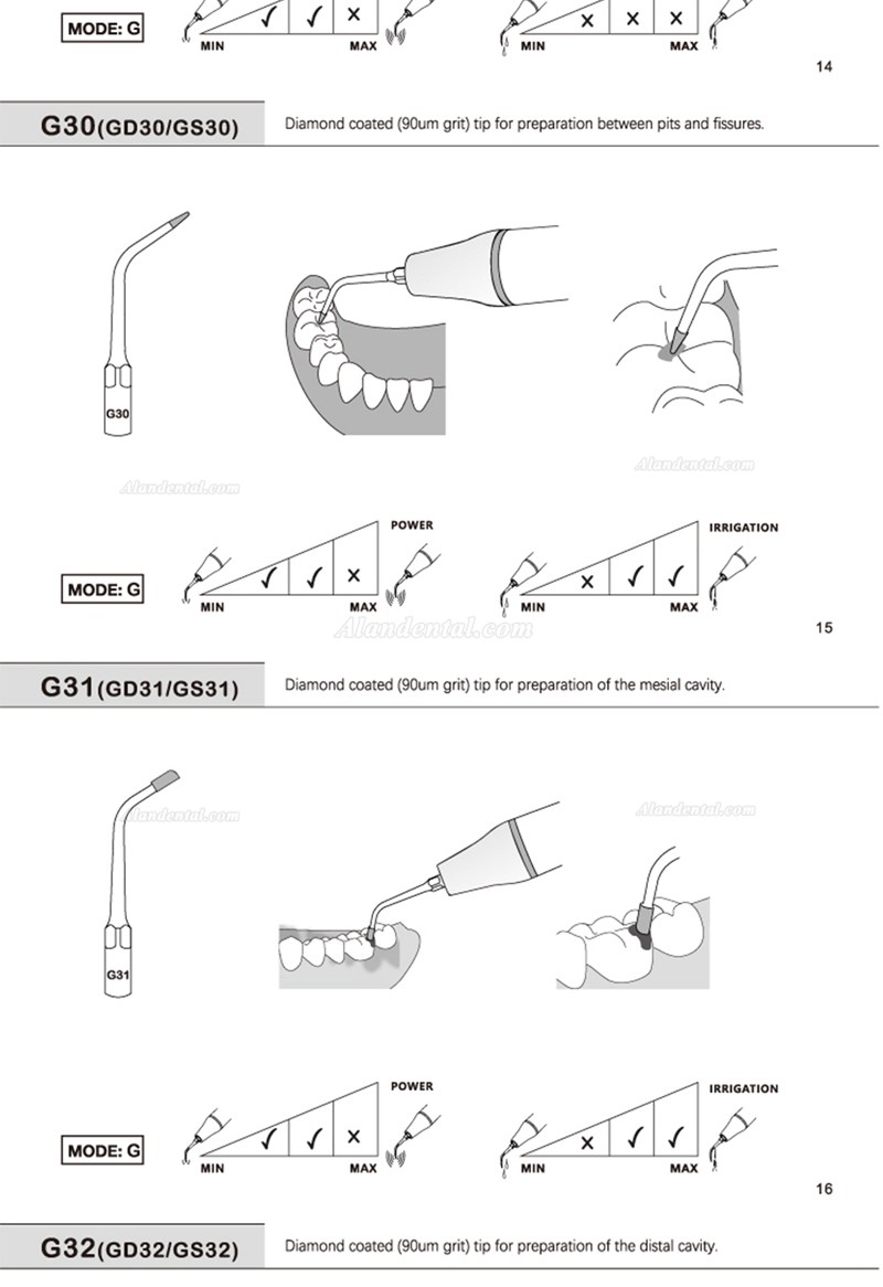 5Pcs Refine® Ultrasonic Scaling Tips G20 G21 G30 G31 G32 G33 G35 Compatible with REFINE EMS Woodpecker Scaler Handpiece