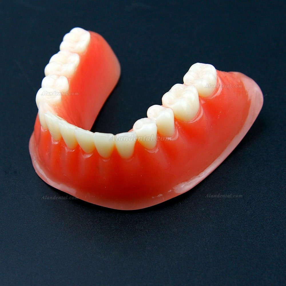 Dental Overdenture Typodont Model Inferior Precision Implant Golden 6009