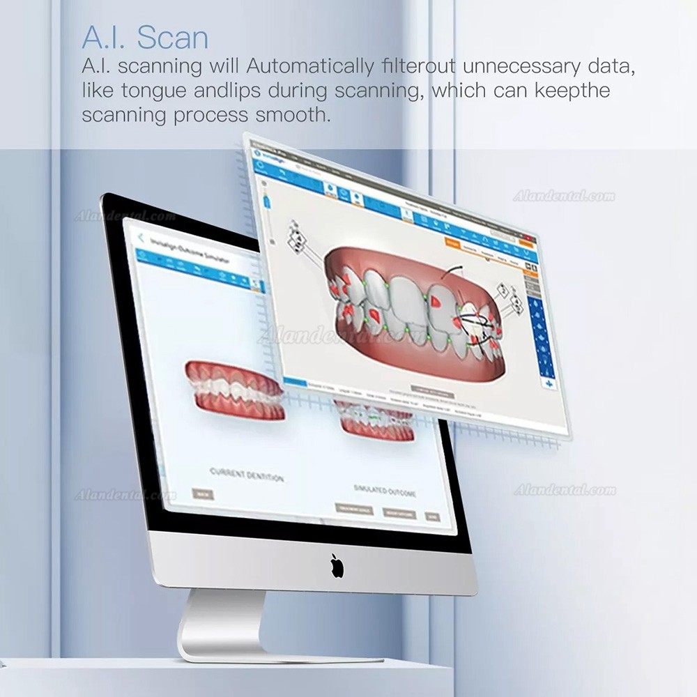 Buy Cheap INO100 Dental Intraoral 3D Scanner Real Color 3D Dental ...