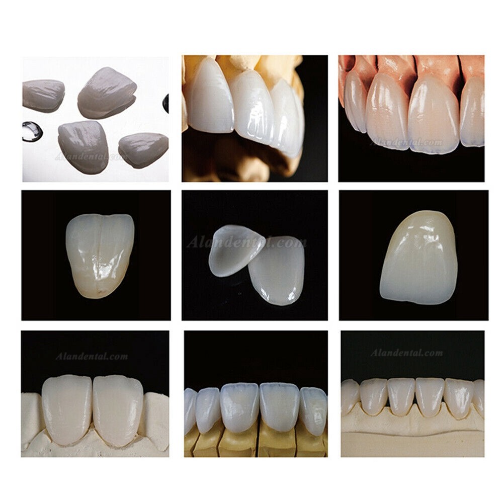 5Pcs B40 HT/LT Dental Lithium Dislicate Glass Ceramic Blocks E-max For Sirona Cerec CAD/CAM Milling System