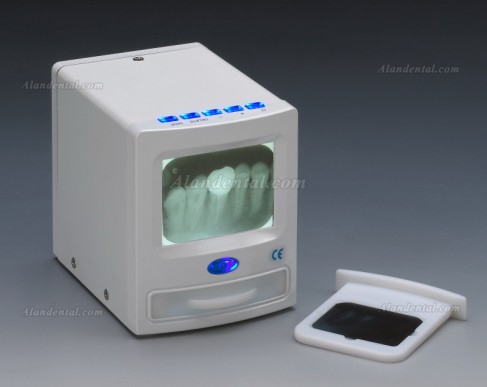 MLG® M-188 Handy View 2.5 inch LCD Dental X-ray Film Reader